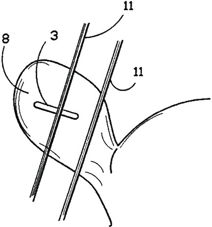 Demonstrating how the unique Enduro Tags double pin clip has no snag catch point with fencing wire