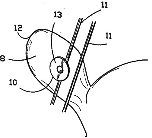 Showing how typical single pin button tags are able to catch fencing wire which can lead to snagging and tag loss